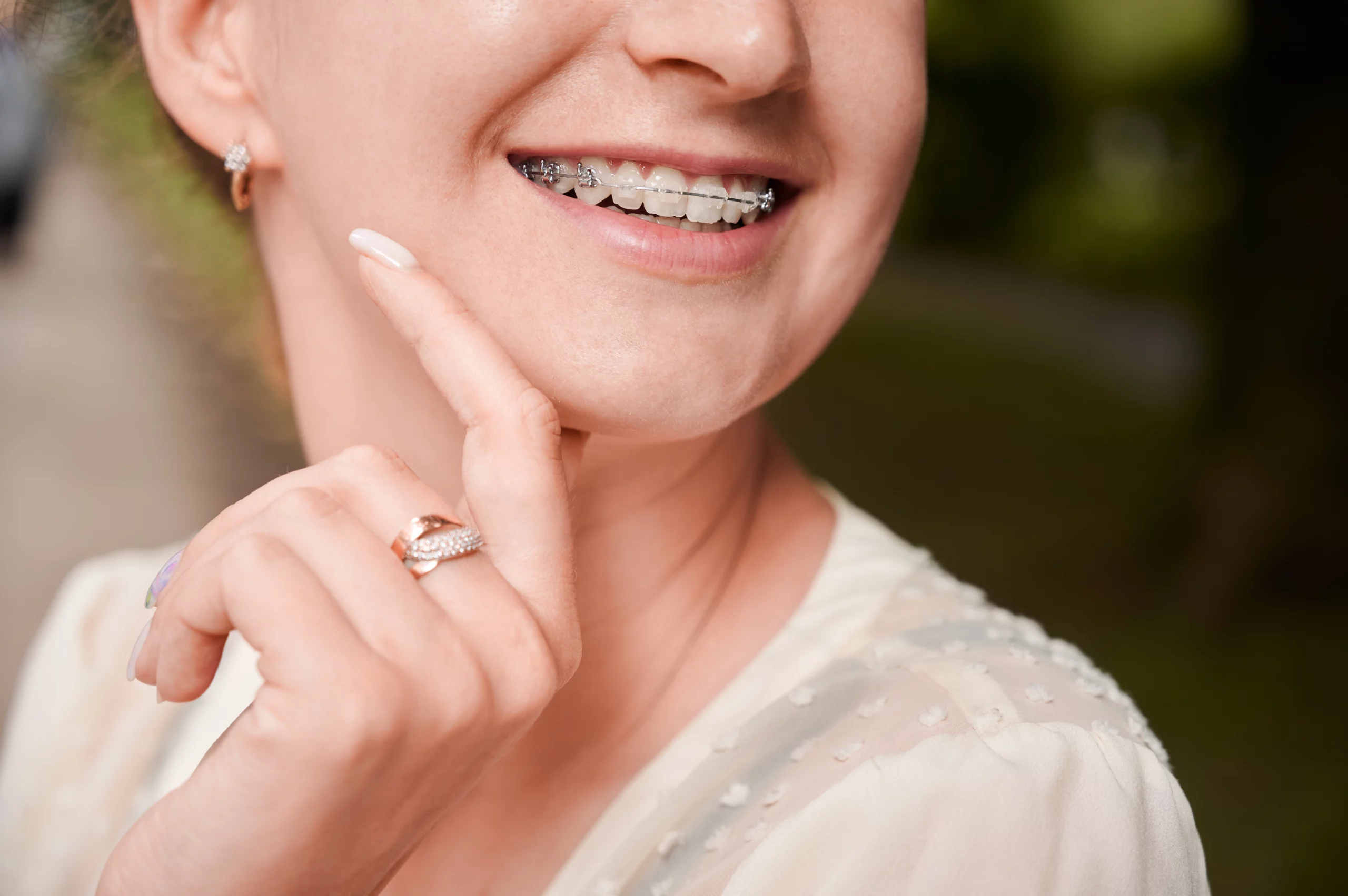 L’Importance de l’Orthodontie pour une Bonne Santé Buccale