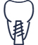 Implant